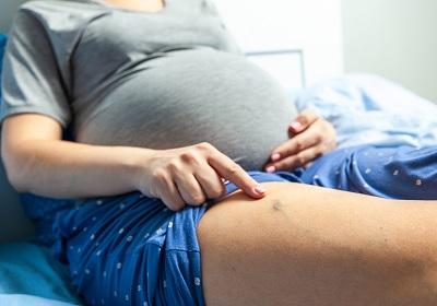 Симптомы варикоза во время беременности