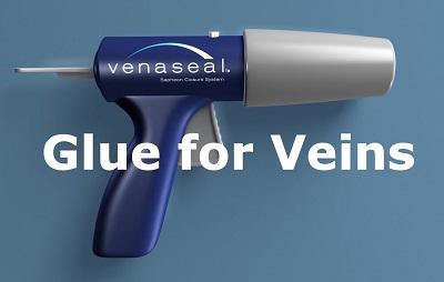 Glue Literation with the Venaseal method