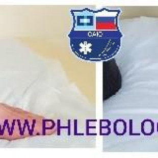 Трофические язвы на ногах - лечение лазером