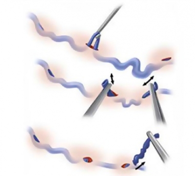 Минифлебэктомия в Москве &mdash; современное удаление варикозных вен нижних конечностей
